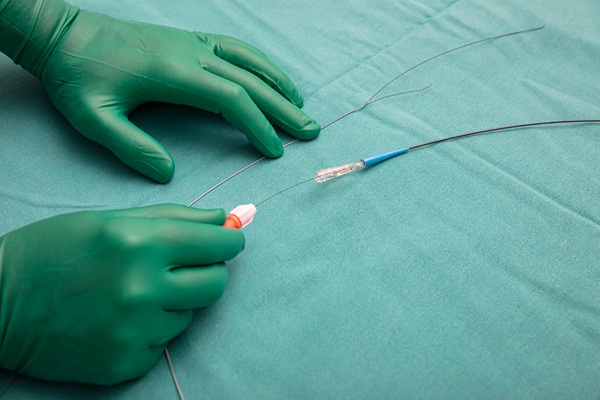 The Benefits Of Angioplasty For Treating Blocked Arteries